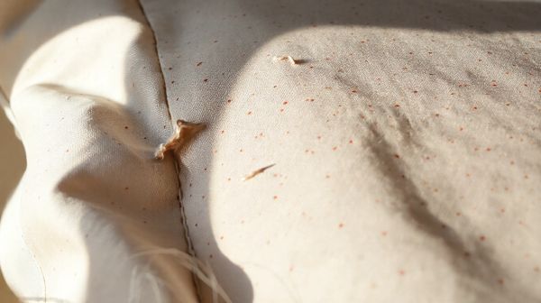 Identifier rapidement les symptômes des punaises de lit